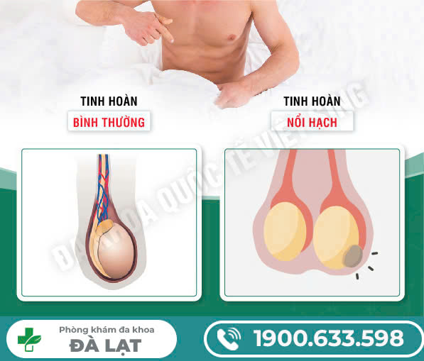 Block Image